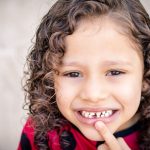 Caduta denti da latte: a che età avviene e cosa fare quando inizia