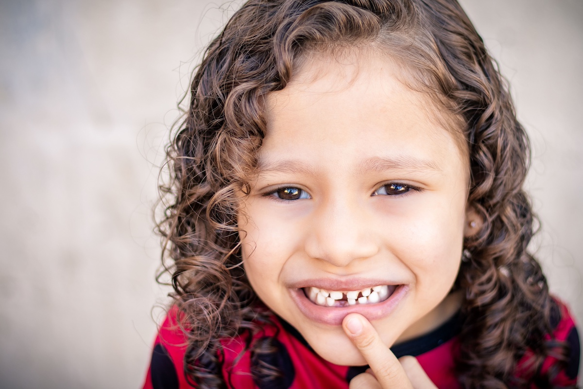 Caduta denti da latte: a che età avviene e cosa fare quando inizia